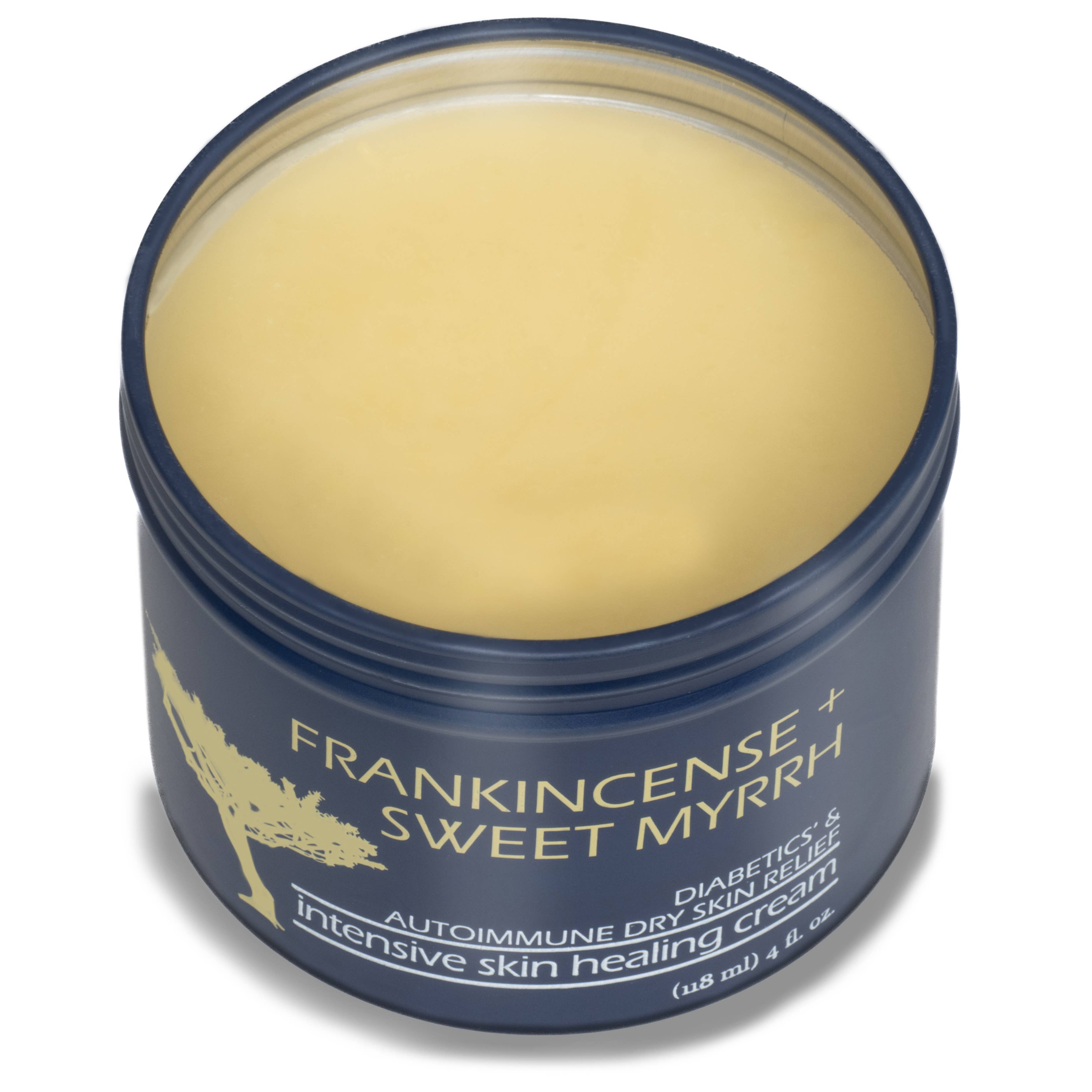 Blue jar of Frankincense Sweet Myrrh Intensive Skin Healing Tallow based Cream on a white background
